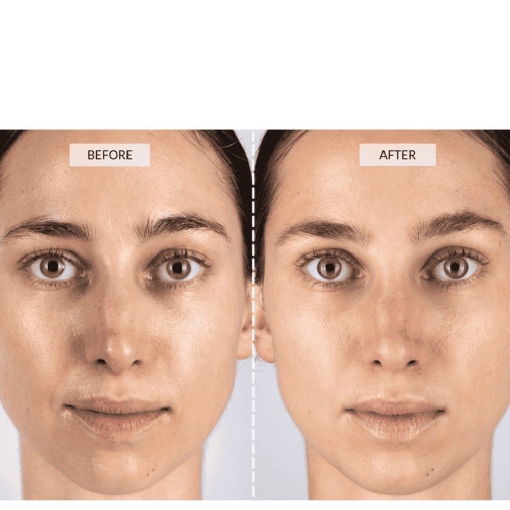 LED Light Therapy Face Mask - Multicolor - Picture 6 of 8